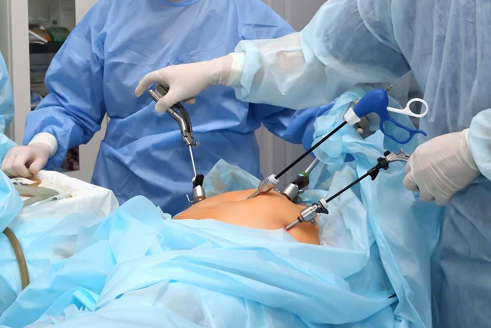 top laparoscopic surgeons in Dwarka